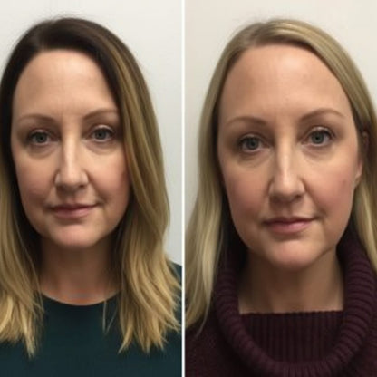 Eyelida Lymphatic Face Brush