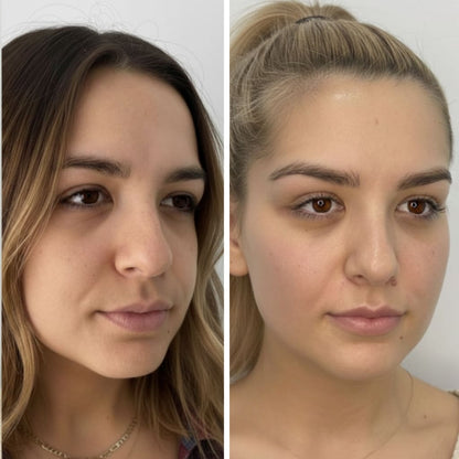 Eyelida Lymphatic Face Brush